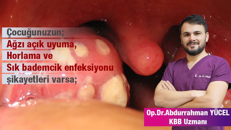 UYARI! Geniz Eti, Çocuğunuzun Büyüme Hızını Düşürüyor Olabilir