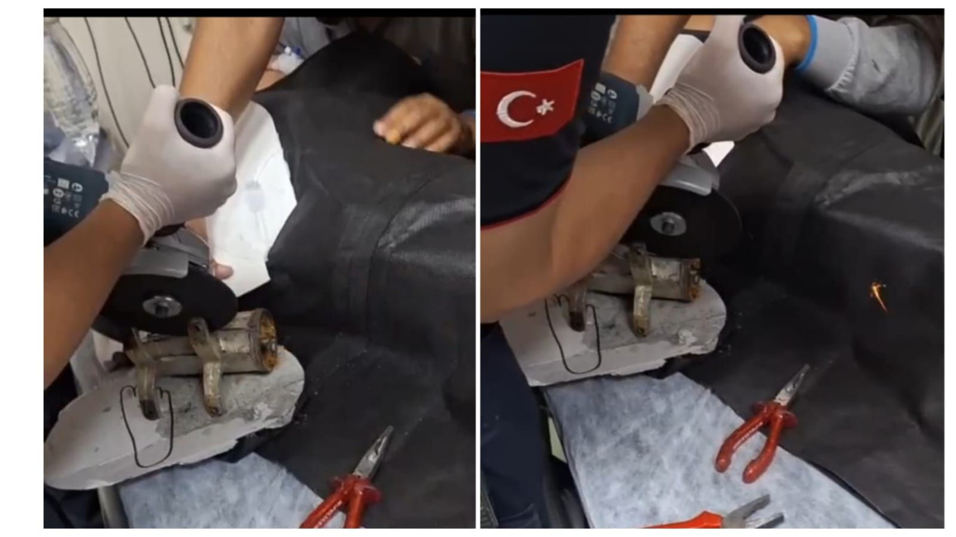 Şanlıurfa’da Eli Kıyma Makinesine Sıkışan Çocuk Kurtarıldı