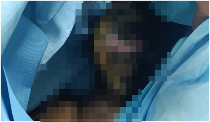 Şanlıurfa’da Yangın Faciası: 7 Yaşındaki Poyraz Efe’den Acı Haber