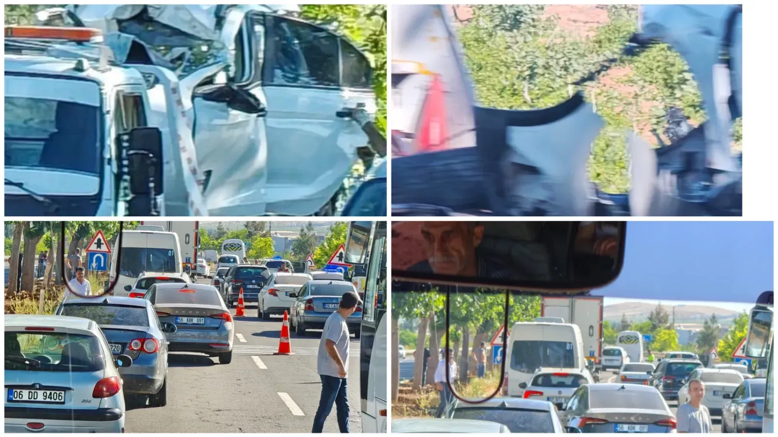 Karaköprü'de Feci Kaza: 1 Ağır Yaralı