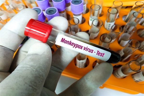 Maymun çiçeği virüsü hakkında bilinmesi gerekenler